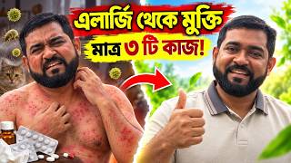 বারবার এলার্জি হচ্ছে? শুধু ওষুধ নয়, এই ৩টি অভ্যাস গড়ে তুলুন #AllergyRelief #HealthyHabits