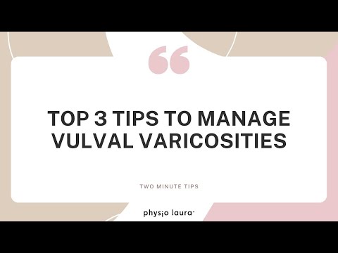 Top 3 tips to manage vulval varicosities