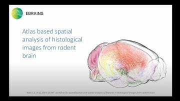 Atlas based spatial analysis of histological images from rodent brain