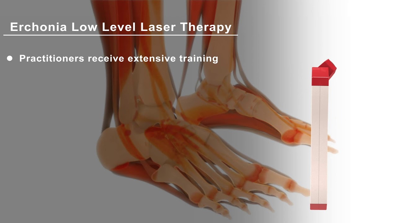 How the Erchonia Low Level Laser Helps Treat Foot Pain Quick Version
