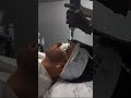 CARBON FACIALS #beauty #wellness #aesthetics