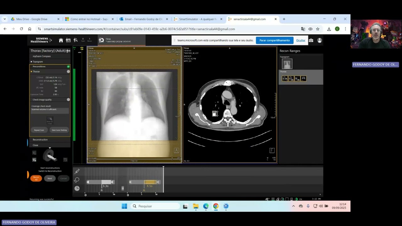 Um apanhado sobre a realização da tomografia computadorizada do tórax - Smart Simulador Siemens