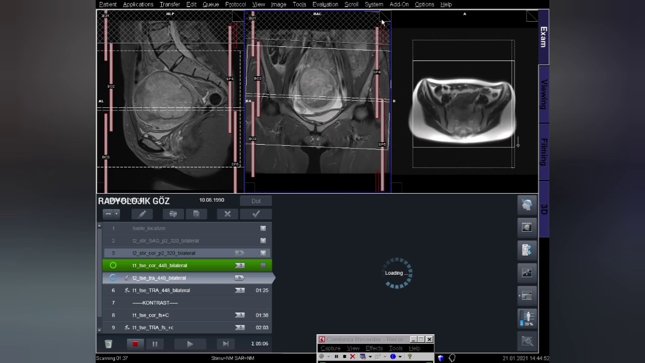 KONTRASTLI PELVİK EMAR (MR) ÇEKİMİ