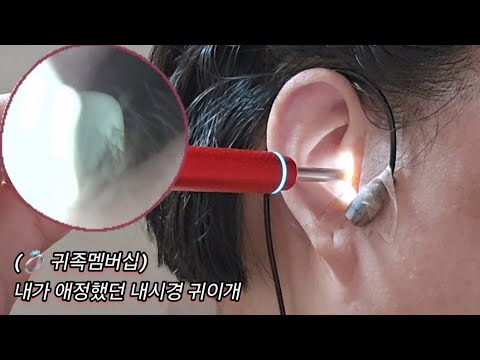 💍Nobility Membership_ 내가 좋아하던 내시경귀이개_ The endoscopic ear pick I liked_  私が好きだった内視鏡耳かき
