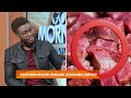 GMN INTERVIEW | FMD OUTBREAK THREATEN'S NAMIBIA'S LIVESTOCK ECONOMY - nbc