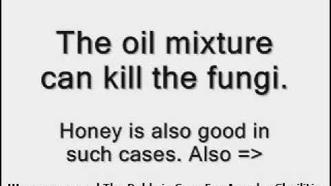 Angular Cheilitis Remedies - Use These Home Remedies To Cure Angular Cheilitis