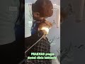 Daant me fasa khana… ban sakta hai problem 😬🦷Abhi clean karwaye!”#dentist #viralvideo #trendingnow