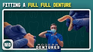 Fitting a Full Upper & Lower Denture (My Complete Process) | Modern Dentures