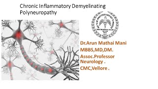 Chronic Inflammatory Demyelinating Polyneuropathy CIDP   Dr.Arun Mathai, CMC, Vellore.