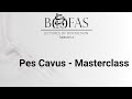 Pes cavus masterclass  bofas lectures of distinction