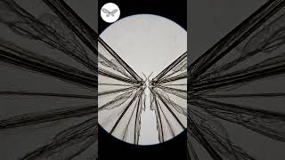 Mosquito Wing | AI Microscope View