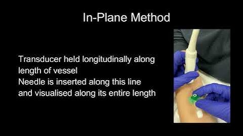 Ultrasound-Guided Vascular Access