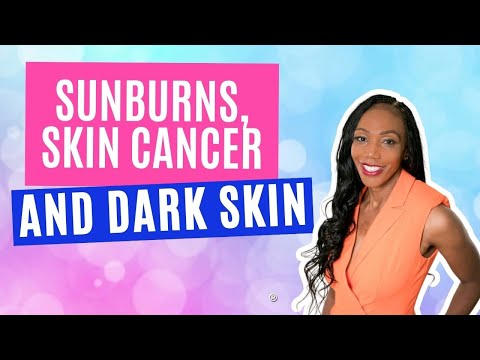 Sunburns, Skin Cancer & Dark Skin