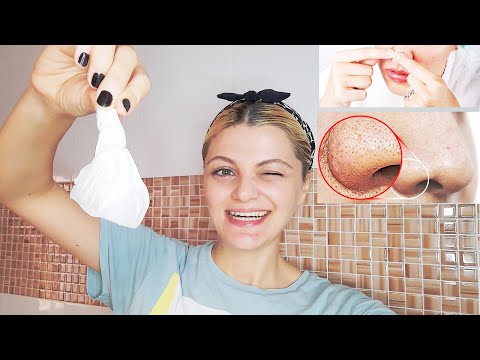 როგორ მოვიშოროთ შავი წერტილები,ფერისმჭამელები