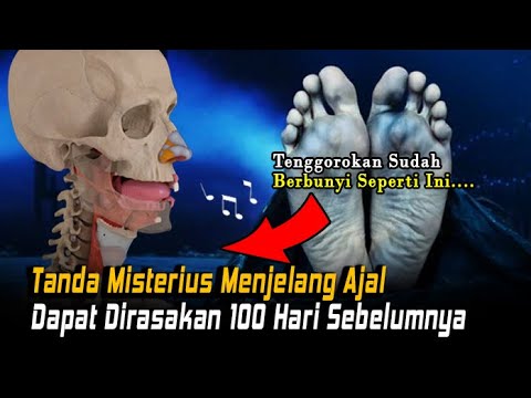 Video: Apa artinya terpaku dalam kematian?