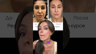 КАК СОХРАНИТЬ ОВАЛ ЛИЦА🔥ЗАКРЫВАЮ ЛЕГЕНДАРНЫЙ КУРС🔥3 МЕС ПО ЦЕНЕ ГОДА🔥ССЫЛКА В ШАПКЕ КАНАЛА