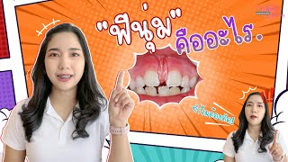 ฟีนุ่ม คืออะไร ไม่ตัดได้ไหม!!!#พบหมอฟัน#pobmorfun#doctorannedds#ทำฟันพังงา#จัดฟันพังงา screenshot 4