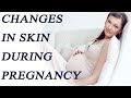 Skin changes during pregnancy all you need to know  boldsky