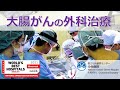 大腸がんの外科治療～国立がん研究センター中央病院大腸外科紹介～【国立がん研究センター中央病院】