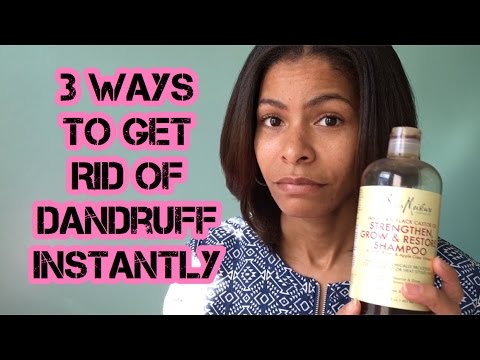 How To Get Rid Of Scalp Odor Natural Hair How To Get Rid Of Scalp Odor Natural Hair