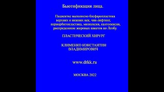 Периорбитопластика, чик-лифтинг, миопексия, кантопексия, распределение жировых пакетов по Лоэбу.