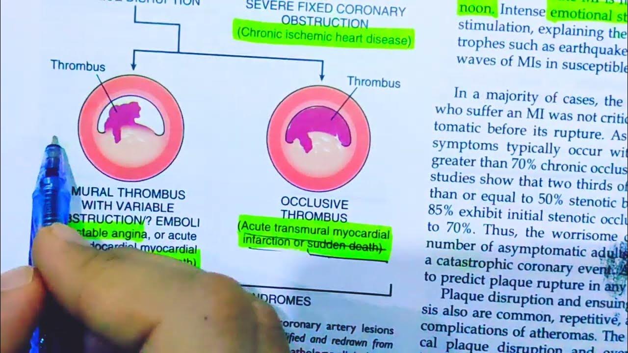 ischemic-heart-disease-pathology-of-ischemic-heart-disease-acute