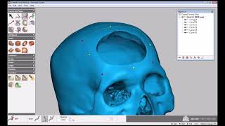 16 - Geomagic Freeform Sculpt, Cranial Implant Design