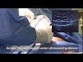 Peritoneal Dialysis Video: Percutaneous Insertion Technique | Medtronic