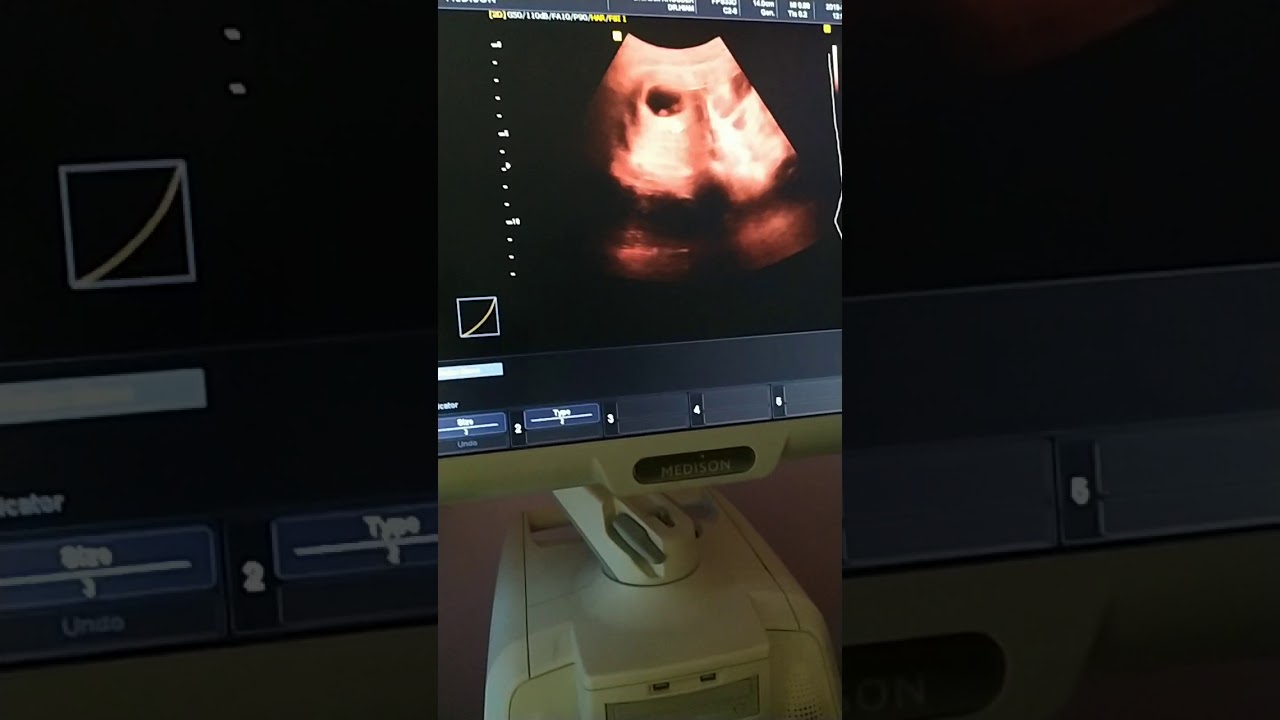 #توأم تعالوا نشوف 👍💙🌳👍💙