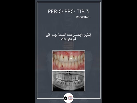 Can mental illness lead to periodontal disease