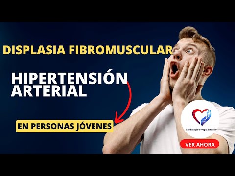 Vídeo: A displasia fibromuscular causa acidente vascular cerebral?