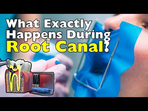 What Happens Inside Your Tooth During a Root Canal?
