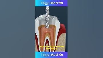 Hậu Qủa Của Sâu Răng Vào Tủy | Nha Khoa Minh Châu