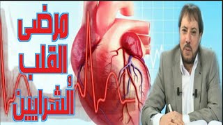 يشرح لنا الدكتور أبو علي الشيباني عن مرض القلب واعراضه  +عدة وصفات لأمراض القلب