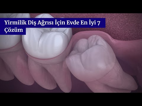 Yirmilik Diş Ağrısı İçin Evde En İyi 7 Çözüm