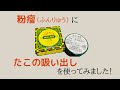 粉瘤（ふんりゅう）に、たこの吸い出しで治った8日間の経過