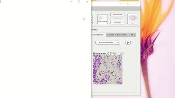 Importing ONNX Model for transfer learning in MATLAB