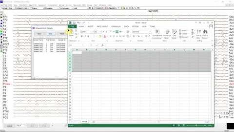 MEG/EEG Waveform Analysis--automatically record measurements