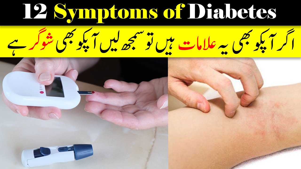 12 Symptoms Of Diabetes In Urdu Type 1 Or Type 2 YouTube