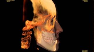 3D Soft Tissue Simulation with Invivo5