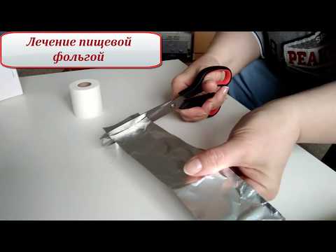 Лечение фольгой