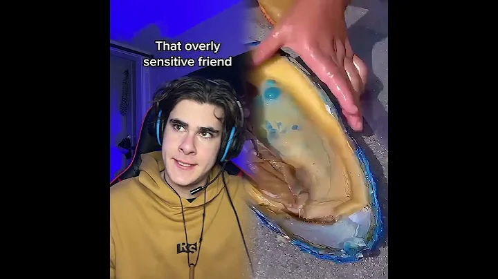 LOL #fyp #funny #xyzcba #viral_video