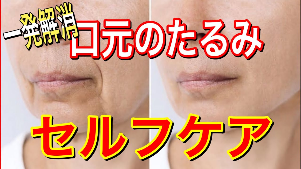 【口元のたるみ解消】顔、口元のたるみを一気に引き上げる方法とは?