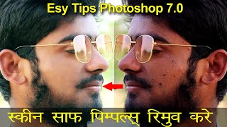 How to Smooth Skin and Remove Pimples in photoshop |photoshop me pimples kaise hataye [Hindi] |