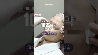 두상이 예뻐지고 싶다면 받으면 좋은 시술! #측두필러