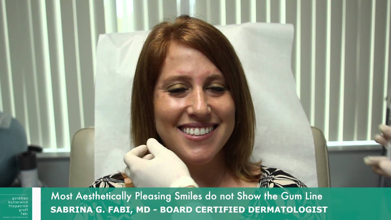 Gummy Smile Correction | Botox San Diego | Dr. Sabrina Fabi