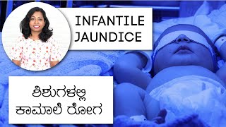 ಶಿಶುಗಳಲ್ಲಿನ ಕಾಮಾಲೆ ರೋಗ | Newborn Jaundice - Risks, Diagnosis & Treatment in Kannada