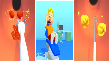 Earwax Clinic in Max Levels Mobile Game Walkthrough Update All Trailers iOS,Android Gameplay