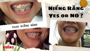 Hành trình niềng răng 🦷! NÊN hay KHÔNG NÊN niềng | Niềng Răng có đau không ??