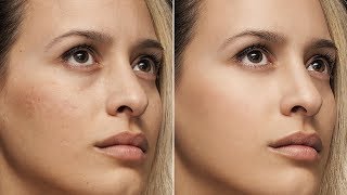 Basic skin retouch tutorial in photoshop